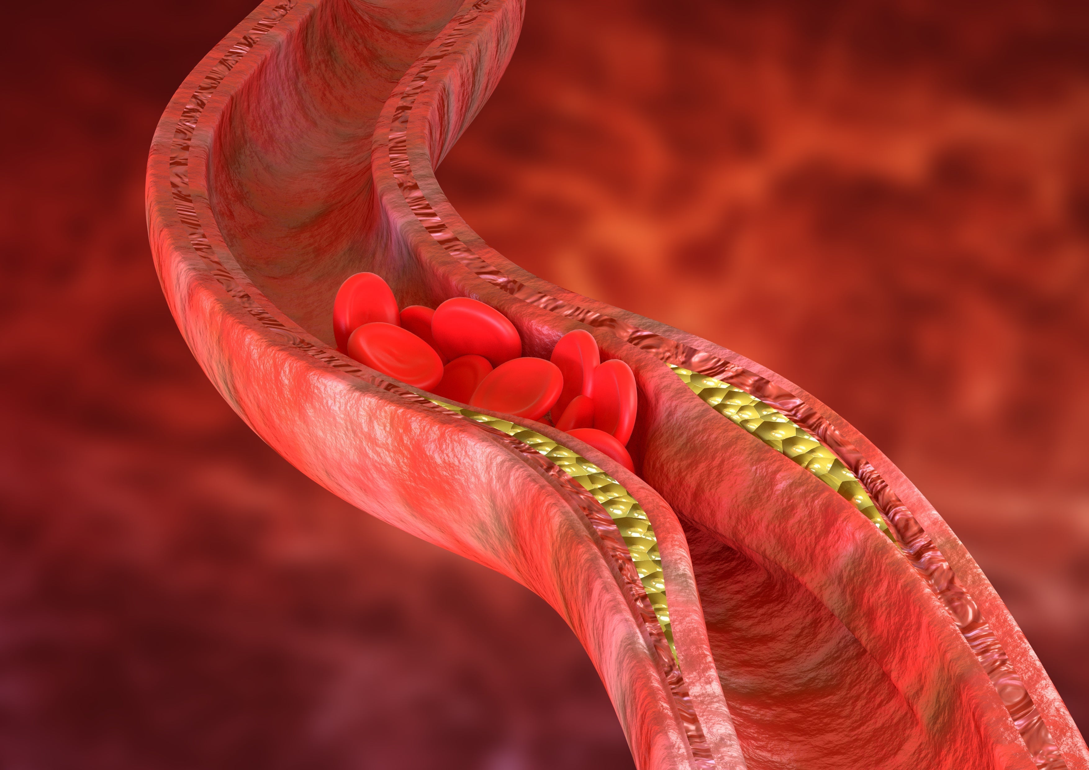 picture of blood vessle